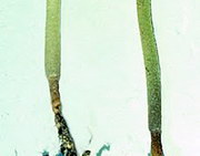 Черная ножка. Болезни растений